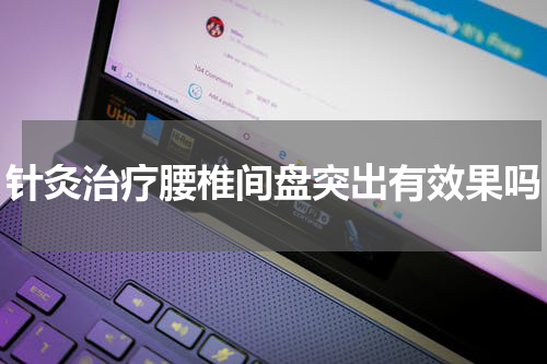针灸治疗腰椎间盘突出有效果吗