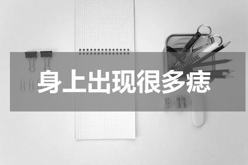 身上出现很多痣